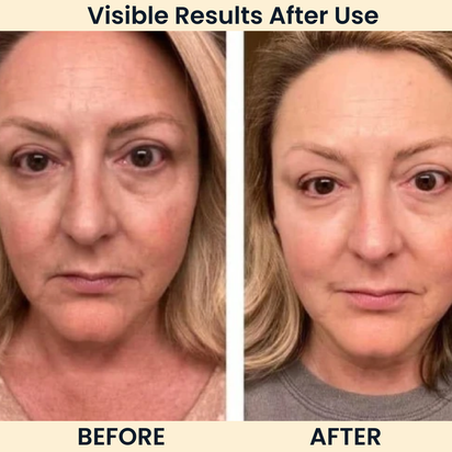 Vydrah OneStep Collagen Wrapping Mask