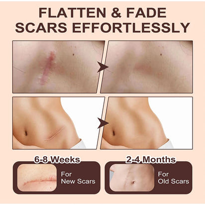 Vydrah™ Silicone Scar Stick ali express