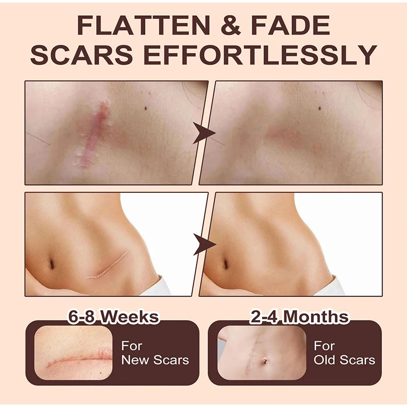 Vydrah™ Silicone Scar Stick ali express