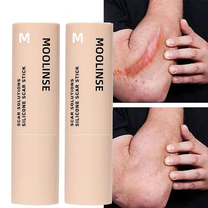 Vydrah™ Silicone Scar Stick ali express