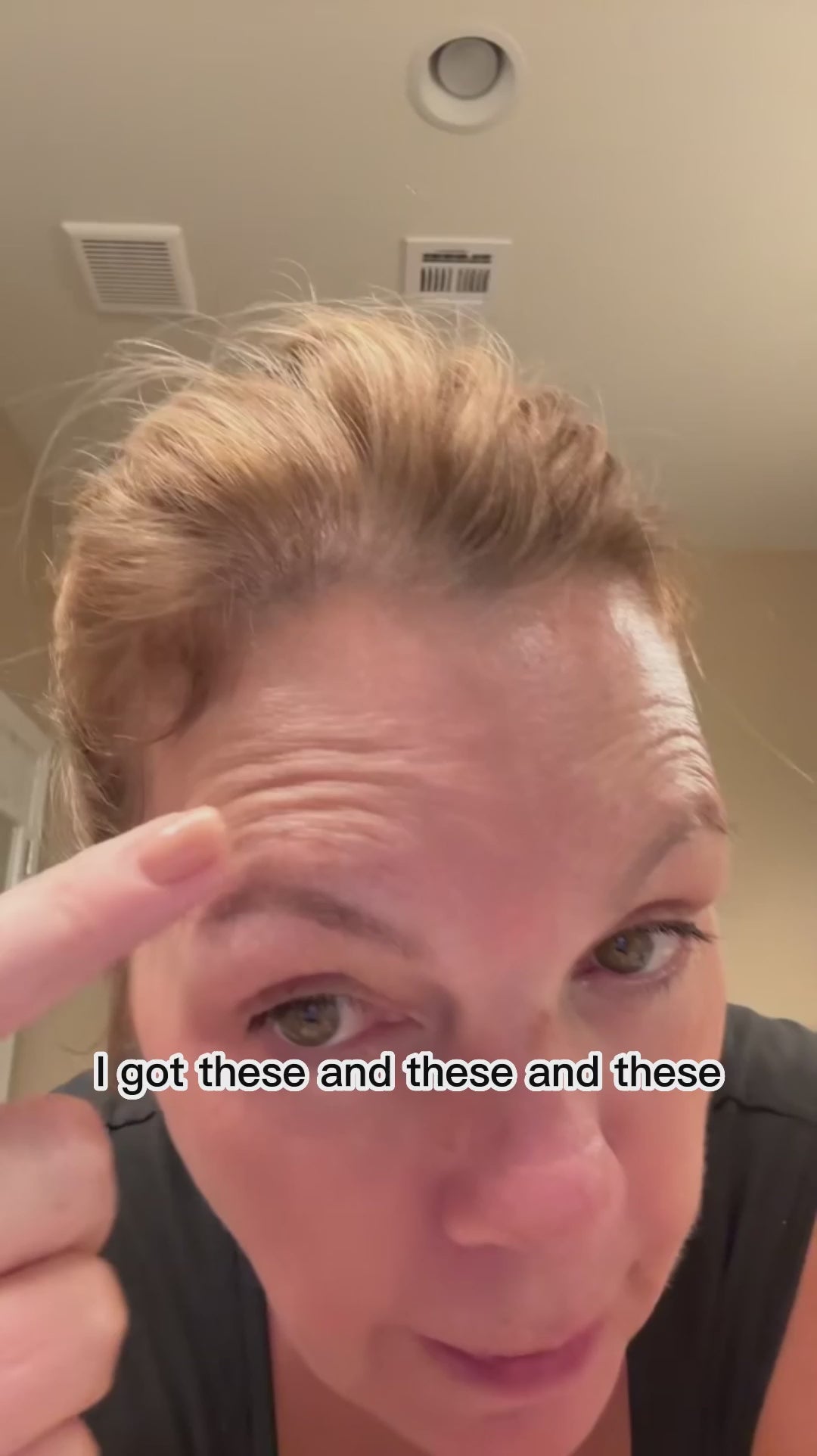 Vydrah™ Silicone Scar Stick video